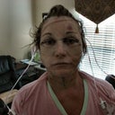 facelift day 2.jpg